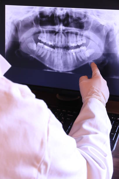 Best Emergency Root Canal Treatment in Bowling Green, VA